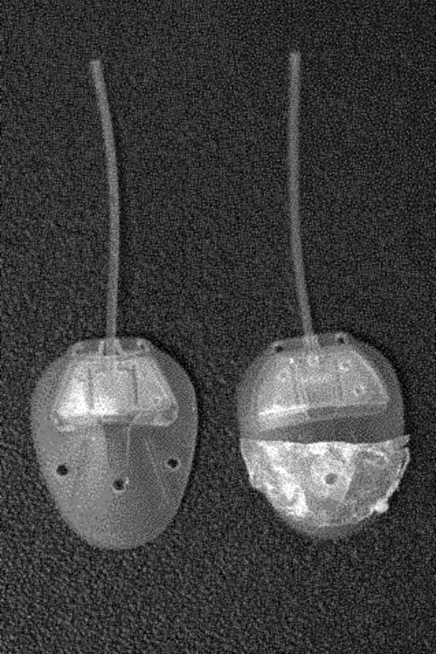 Photograph of two Ahmed glaucoma valves: a commercial valve, and one coated with a breath-figure PLGA film.